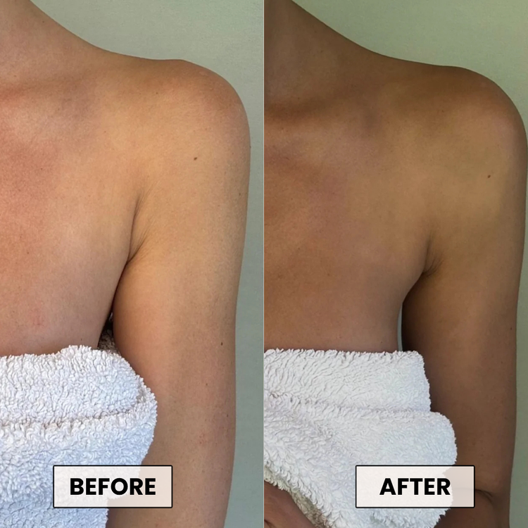 Before and After