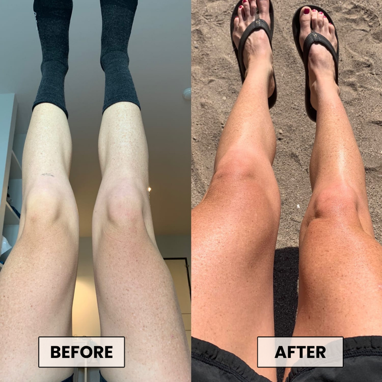 Before and After