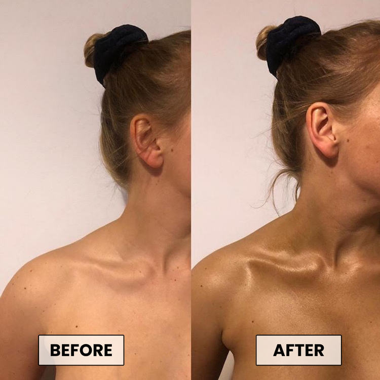 Before and After